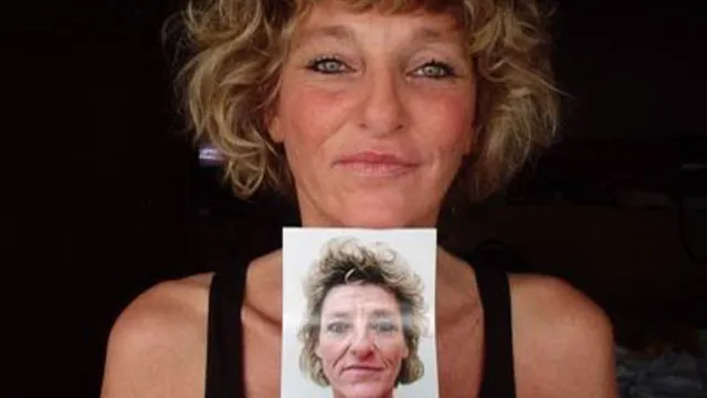 Ingeborg Beugel na en voor de operatie