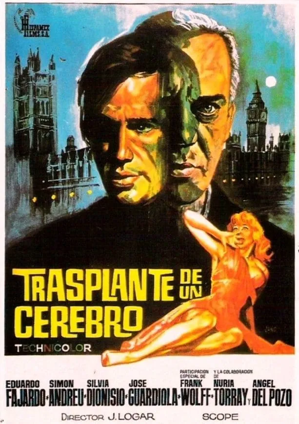 Trasplante de un cerebro poster